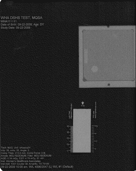 TFG Ruler scan image